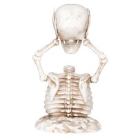 Halloween Deko Skelett mit abgerissenem Kopf